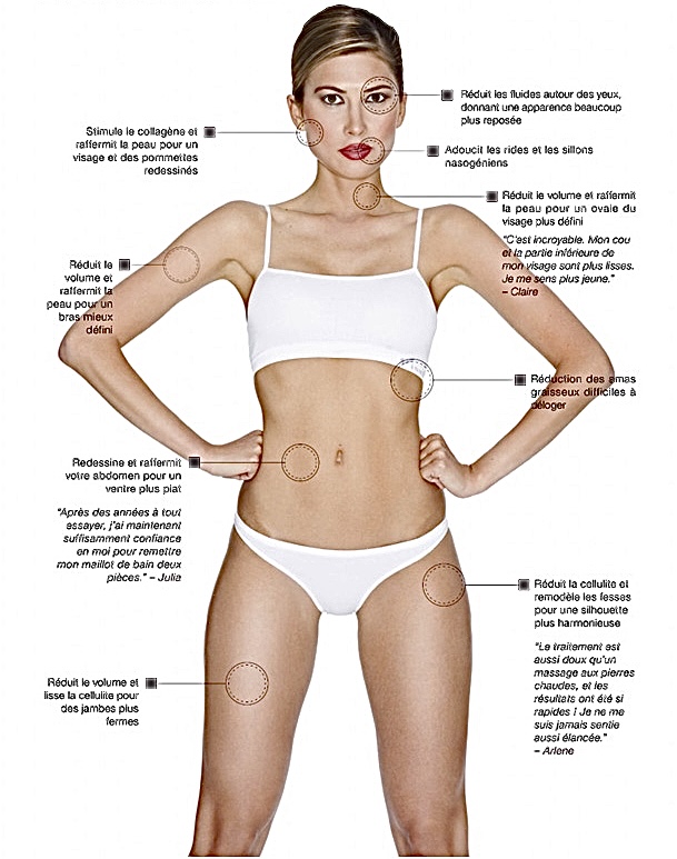 Lipocavitation et Radiofréquence - Sphère Beauté